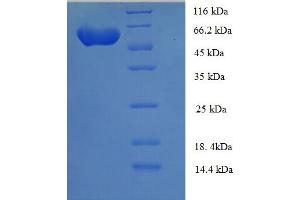 SDS-PAGE (SDS) image for Serine/threonine-Protein Kinase NIM1 (NIM1) (AA 1-436), (full length) protein (His-SUMO Tag) (ABIN5711507) (NIM1 Protein (AA 1-436, full length) (His-SUMO Tag))