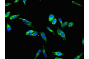 Immunofluorescent analysis of Hela cells using ABIN7147989 at dilution of 1:100 and Alexa Fluor 488-congugated AffiniPure Goat Anti-Rabbit IgG(H+L) (Coagulation Factor IX 抗体  (AA 144-239))