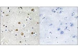 Immunohistochemistry analysis of paraffin-embedded human brain tissue, using TF3B Antibody. (BRF1 抗体  (AA 231-280))