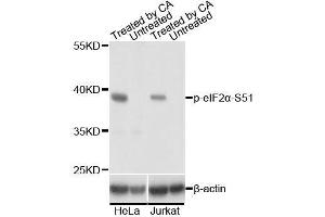 Western blot analysis of extracts of HeLa and Jurkat cells,using Phospho-eIF2α-S51 antibody. (EIF2S1 抗体  (pSer51))