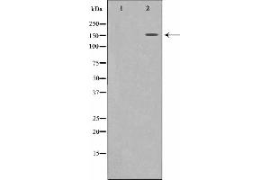 Western blot analysis on 293 cell lysate using MRC2 Antibody,The lane on the left is treated with the antigen-specific peptide. (MRC2 抗体  (N-Term))