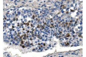 IHC analysis of TMPRSS3 using anti-TMPRSS3 antibody (ABIN7601198). (TMPRSS3 抗体  (AA 3-454))