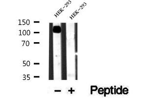 Western blot analysis of extracts of HEK-293 cells, using alpha Adaptin antibody. (alpha Adaptin 抗体  (Internal Region))