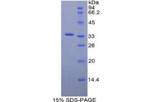 SDS-PAGE analysis of Mouse ECE1 Protein. (ECE1 蛋白)