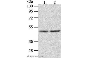 Western blot analysis of Human fetal liver tissue and hepg2 cell, using AGXT Polyclonal Antibody at dilution of 1:1050 (AGXT 抗体)