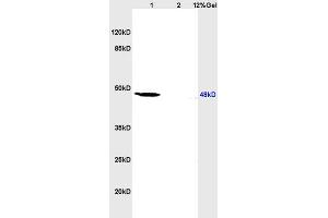 L1 human colon carcinoma lysates L2 rat heart lysates probed with Anti IL-2R gamma/CD132 Polyclonal Antibody, Unconjugated (ABIN669516) at 1:200 overnight at 4 °C. (Retinoic Acid Receptor beta 抗体  (AA 155-250))