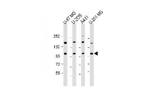 All lanes : Anti-THSD1 Antibody (C-Term) at 1:2000 dilution Lane 1: U-87 MG whole cell lysate Lane 2: U-2OS whole cell lysate Lane 3: A431 whole cell lysate Lane 4: U-251 MG whole cell lysate Lysates/proteins at 20 μg per lane. (THSD1 抗体  (AA 668-699))