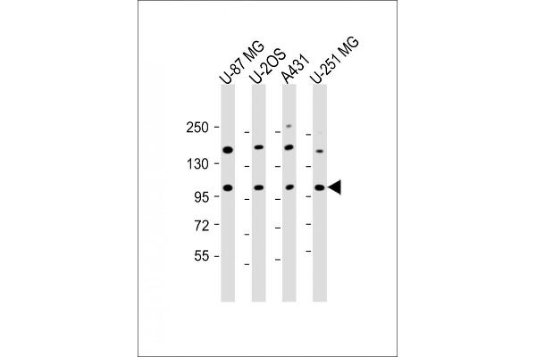 THSD1 antibody  (AA 668-699)