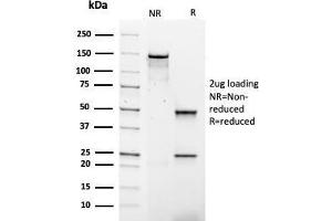 SDS-PAGE Analysis Purified IgG4 Mouse Recombinant Monoclonal Antibody (rIGHG4/1345). (Recombinant IGHG4 抗体)
