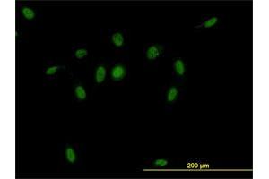 Immunofluorescence of monoclonal antibody to CSE1L on HeLa cell. (Exportin 2 抗体  (AA 872-971))