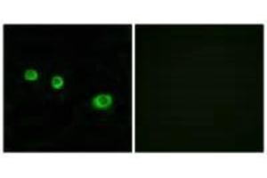 Immunofluorescence analysis of MCF-7 cells, using GBP1 antibody.