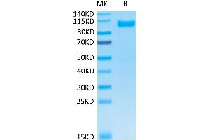 Human DPPIV on Tris-Bis PAGE under reduced condition. (DPP4 Protein (AA 29-766) (His tag))