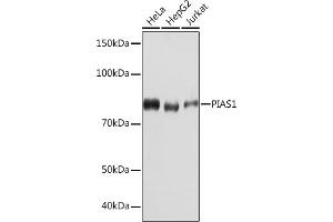 Western blot analysis of extracts of various cell lines, using PI Rabbit mAb (ABIN7269622) at 1:1000 dilution.