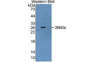 Detection of Recombinant LIM2, Human using Polyclonal Antibody to Lens Intrinsic Membrane Protein 2 (LIM2) (LIM2 抗体  (AA 30-136))