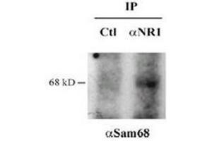 Immunoprecipitation with anti NR1 or control Western blot anti Sam68 (KHDRBS1 抗体)