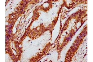 Immunohistochemistry (IHC) image for anti-NADPH Oxidase 1 (NOX1) (AA 418-564) antibody (ABIN7161004)