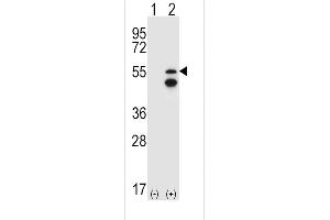 Western blot analysis of FRK (arrow) using rabbit polyclonal FRK Antibody (V28) (ABIN392097 and ABIN2841849).