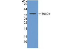 Detection of Recombinant CDH17, Human using Polyclonal Antibody to Cadherin 17 (CDH17) (LI Cadherin 抗体  (AA 67-351))
