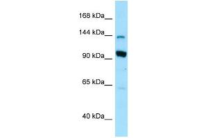 WB Suggested Anti-USO1 Antibody Titration: 1. (USO1 抗体  (N-Term))