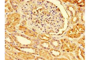 Immunohistochemistry (IHC) image for anti-Peroxiredoxin 3 (PRDX3) (AA 63-256) antibody (ABIN7172023)