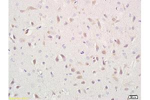 Formalin-fixed and paraffin embedded rat brain labeled with Anti- CD171/NCAM-L1 Polyclonal Antibody, Unconjugated (ABIN676463) at 1:400 followed by conjugation to the secondary antibody and DAB staining (L1CAM 抗体  (AA 1101-1257))