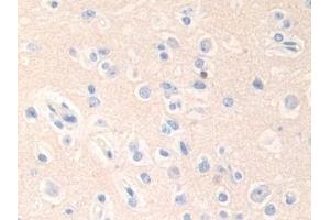Detection of EPN1 in Human Cerebrum Tissue using Polyclonal Antibody to Epsin 1 (EPN1) (Epsin 1 抗体  (AA 279-437))