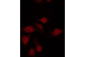 ABIN6275922 staining HepG2 by IF/ICC. (CXCR7 抗体  (Internal Region))