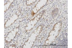 Immunoperoxidase of monoclonal antibody to AQP8 on formalin-fixed paraffin-embedded human colon. (Aquaporin 8 抗体  (AA 1-255))