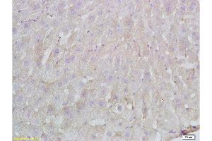 Formalin-fixed and paraffin embedded Rat liver labeled with Anti-FBN1/fibrillin 1 Polyclonal Antibody, Unconjugated  at 1:200 followed by conjugation to the secondary antibody and DAB staining. (Fibrillin 1 抗体  (AA 401-500))