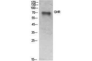 Western Blotting (WB) image for anti-Growth Hormone Receptor (GHR) (Internal Region) antibody (ABIN3181426) (Growth Hormone Receptor 抗体  (Internal Region))