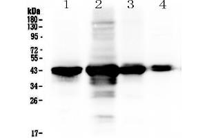 Western blot analysis of PON1 using anti-PON1 antibody . (PON1 抗体  (AA 30-274))