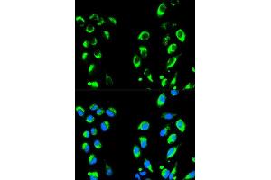 Immunofluorescence analysis of HeLa cells using NFKBIA antibody (ABIN5998339). (NFKBIA 抗体)