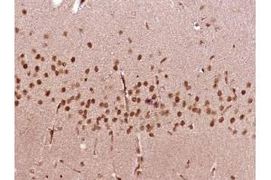 Immunohistochemistry (Paraffin-embedded Sections) (IHC (p)) image for anti-SRY (Sex Determining Region Y)-Box 4 (SOX4) (AA 54-103) antibody (ABIN1387237)