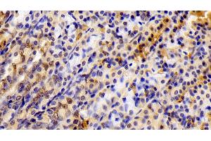 Immunohistochemistry (IHC) image for anti-Signal Transducer and Activator of Transcription 6, Interleukin-4 Induced (STAT6) (AA 557-841) antibody (ABIN7439333)