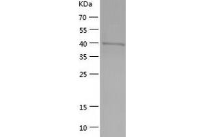 NEIL1 Protein (AA 1-390) (His tag)