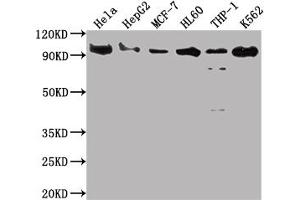 Western Blot Positive WB detected in: Hela whole cell lysate, HepG2 whole cell lysate, MCF-7 whole cell lysate, HL60 whole cell lysate, THP-1 whole cell lysate, K562 whole cell lysate All lanes: SUZ12 antibody at 1:2000 Secondary Goat polyclonal to rabbit IgG at 1/50000 dilution Predicted band size: 84 kDa Observed band size: 90 kDa (Recombinant SUZ12 抗体)
