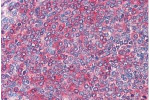 Spleen: Formalin-Fixed, Paraffin-Embedded (FFPE) (FZD7 抗体  (AA 559-572))