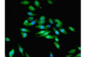 Immunofluorescent analysis of Hela cells using ABIN7168993 at dilution of 1:100 and Alexa Fluor 488-congugated AffiniPure Goat Anti-Rabbit IgG(H+L) (STK33 抗体  (AA 231-514))