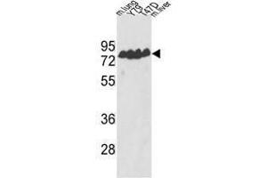 Image no. 1 for anti-Endothelin-Converting Enzyme 1 (ECE1) (Middle Region) antibody (ABIN452931) (ECE1 抗体  (Middle Region))