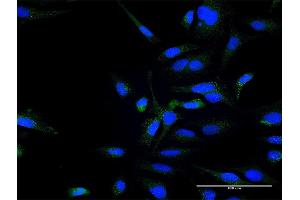 Immunofluorescence of purified MaxPab antibody to ZFYVE16 on HeLa cell. (ZFYVE16 抗体  (AA 1-809))