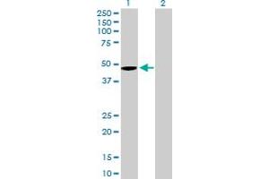 Western Blotting (WB) image for anti-Wingless-Type MMTV Integration Site Family, Member 5B (WNT5B) (AA 1-359) antibody (ABIN529329)
