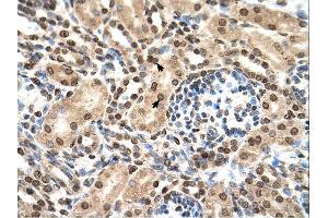 Immunohistochemistry (IHC) image for anti-Interferon-Induced Protein with Tetratricopeptide Repeats 3 (IFIT3) (N-Term) antibody (ABIN2782443) (IFIT3 抗体  (N-Term))