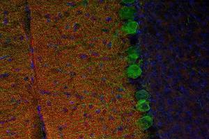 Indirect immunostaining of PFA fixed mouse cerebellum section with anti-M6a Glycoprotein (dilution 1 : 200; red) and mouse anti-calbindin (, dilution 1 : 200; green).