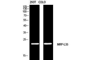 Western Blot (WB) analysis of 293T COLO205 using MRP-L35 antibody. (MRPL35 抗体)