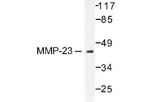 Image no. 1 for anti-Matrix Metallopeptidase 23 (MMP23) antibody (ABIN265530) (Matrix Metallopeptidase 23 (MMP23) 抗体)