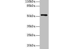 Western blot All lanes: CCDC14 antibody at 2 μg/mL + Jurkat whole cell lysate Secondary Goat polyclonal to rabbit IgG at 1/10000 dilution Predicted band size: 107, 84, 89, 52, 102 kDa Observed band size: 52 kDa (CCDC14 抗体  (AA 159-440))