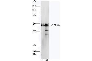 Line1, mouse heart lysate; Line2, mouse liver lysate probed with Rabbit Anti-CYT19 Polyclonal Antibody, Unconjugated (ABIN2559676) at 1:300 in 4˚C.