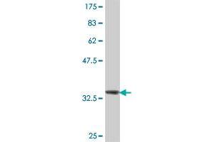 Western Blot detection against Immunogen (37. (UGT1A10 抗体  (AA 187-289))