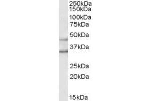 Western Blotting (WB) image for anti-Potassium Inwardly-Rectifying Channel, Subfamily J, Member 6 (KCNJ6) (C-Term) antibody (ABIN2465762) (KCNJ6 抗体  (C-Term))