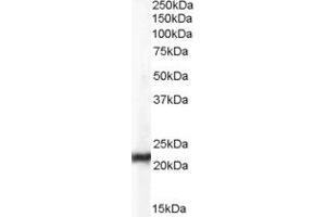Image no. 5 for anti-Chromobox Homolog 5 (CBX5) (Internal Region) antibody (ABIN185491)